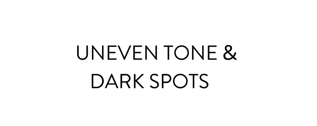 Hyperpigmentation